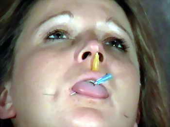Nose needles